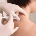 Neuraltherapie und Injektion einen Lokalanästhetikums mit einer sehr feinen Nadel im Bereich der Schulter- und Nackenmuskulatur, z.B. im Rahmen der Migränebehandlung.