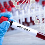 Nichtinvasive pränatale Tests (NIPT) im Rahmen der Schwangerschaftsvorsorge. Hier ein Reagenzglas mit Blutprobe zur weiteren Diagnostik im Labor mit Nahaufnahme und Abbildung einer DNA-Struktur