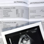 Aufgeschlagener Mutterpass zum Eintragen von Ultraschalluntersuchungen in der Schwangerschaft. Darauf liegt ein Ultraschallbild mit der Darstellung einen kindlichen Kopfes.